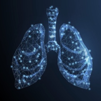 Тизер для онлайн трансляції заходу "Ведення випадку мультирезистентного туберкульозу та ШЛС ТБ"